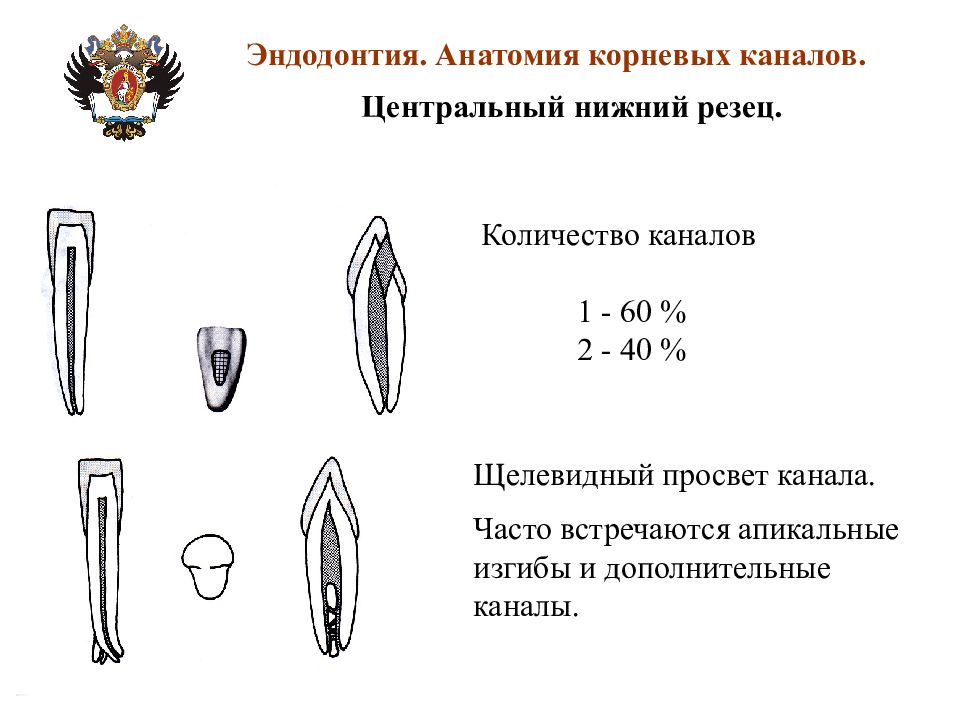 Анатомия каналов. Корневые каналы в нижних резцах. Нижний резец 2 корневых канала. Нижний Центральный резец корневые каналы. Корневые каналы Центральный верхний резец.