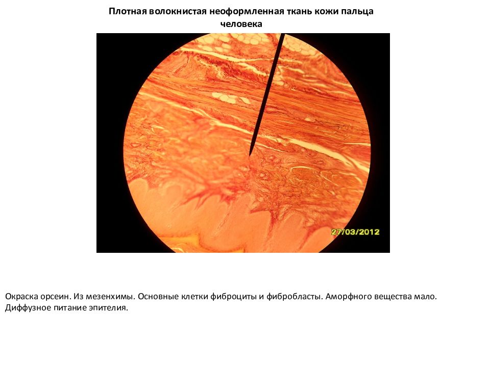 Ткани пальца. Плотная соединительная ткань кожи пальца препарат гистология. Плотная неоформленная соединительная ткань кожи пальца. Кожа пальца волокнистая соединительная ткань человека гистология. Плотная соединительная ткань гематоксилин-пикрофуксин.