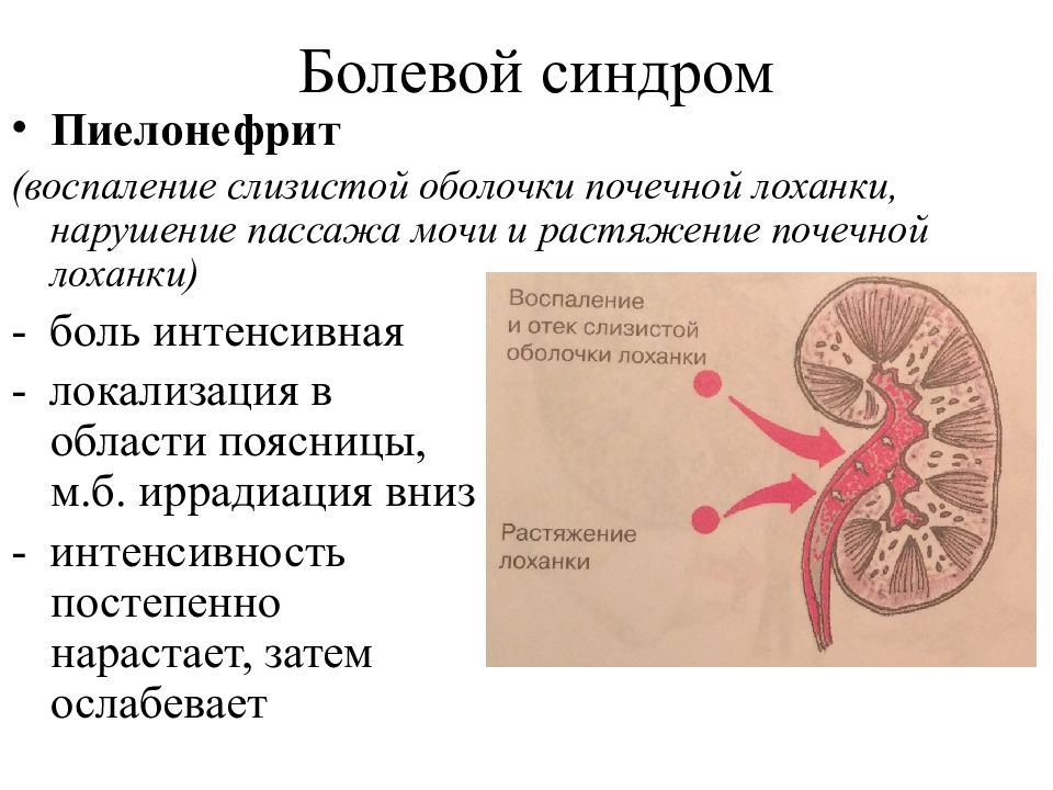 Воспалительные заболевания почек презентация