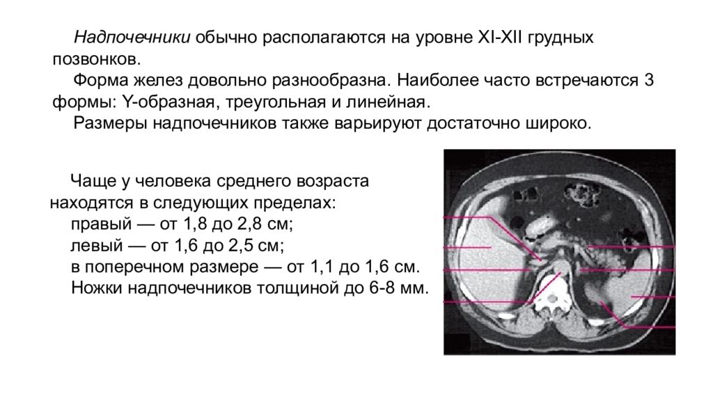 Находиться обычно. Размеры надпочечников на кт в норме. Толщина надпочечников на кт. Анатомия надпочечников кт.