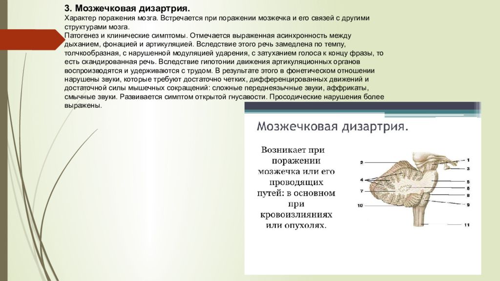 Мозжечковая дизартрия это. Мозжечковая дизартрия патогенез. Сохранные функции при мозжечковой дизартрии;. Мозжечковая дизартрия речевые симптомы. Клиническая картина мозжечковой дизартрии.