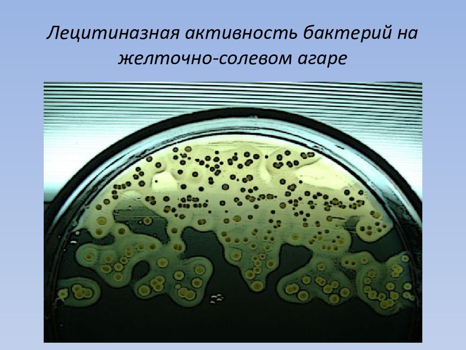 Желточно солевой агар. Лецитиназная активность стафилококка. Лецитиназная активность стафилококков на ЖСА. Лецитиназная активность стафилококка на ЖСА. Лецитиназа на желточно солевом агаре.