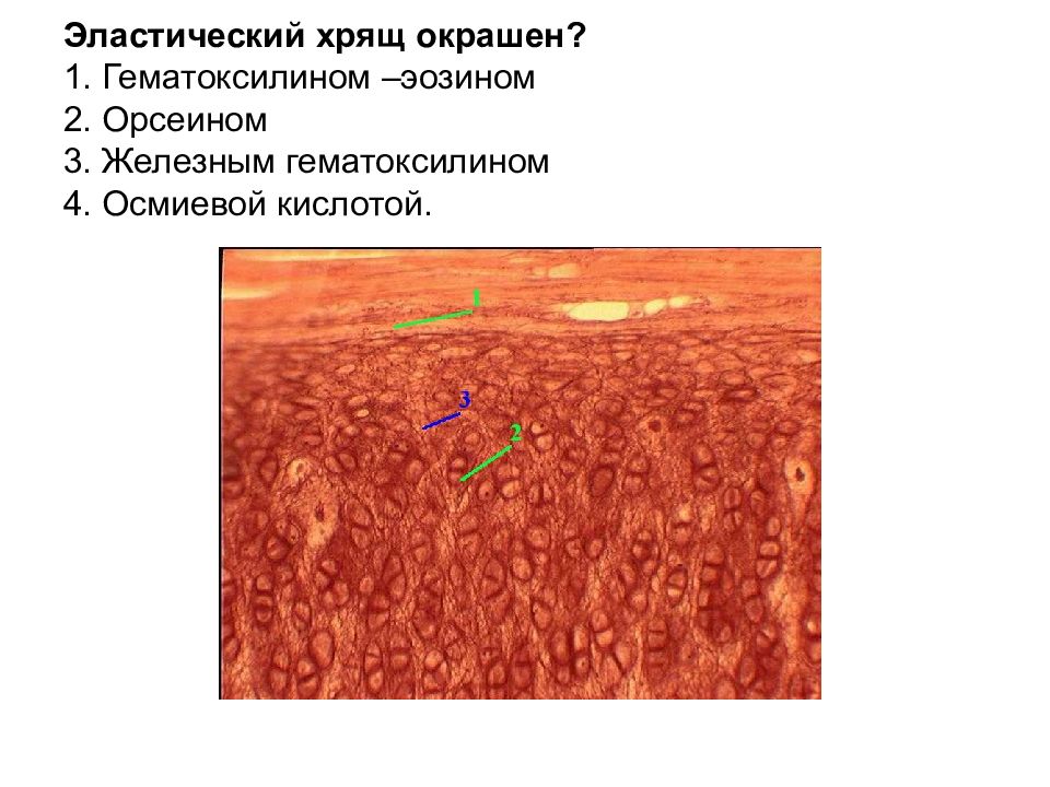 Эластическая связка. Эластический хрящ орсеин гематоксилин. Эластическая хрящевая ткань окраска гематоксилин и орсеин. Эластический хрящ окраска орсеин гематоксилин. Эластический хрящ гистология препарат орсеин.