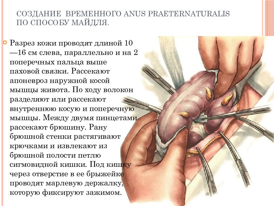 Колостома карта вызова