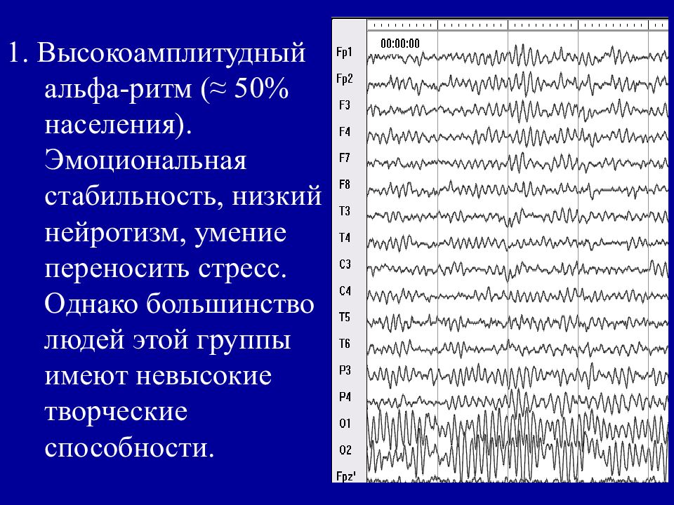 1 нарисовать схему стадий сна по данным ээг