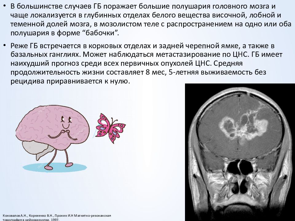 Рак головного мозга презентация