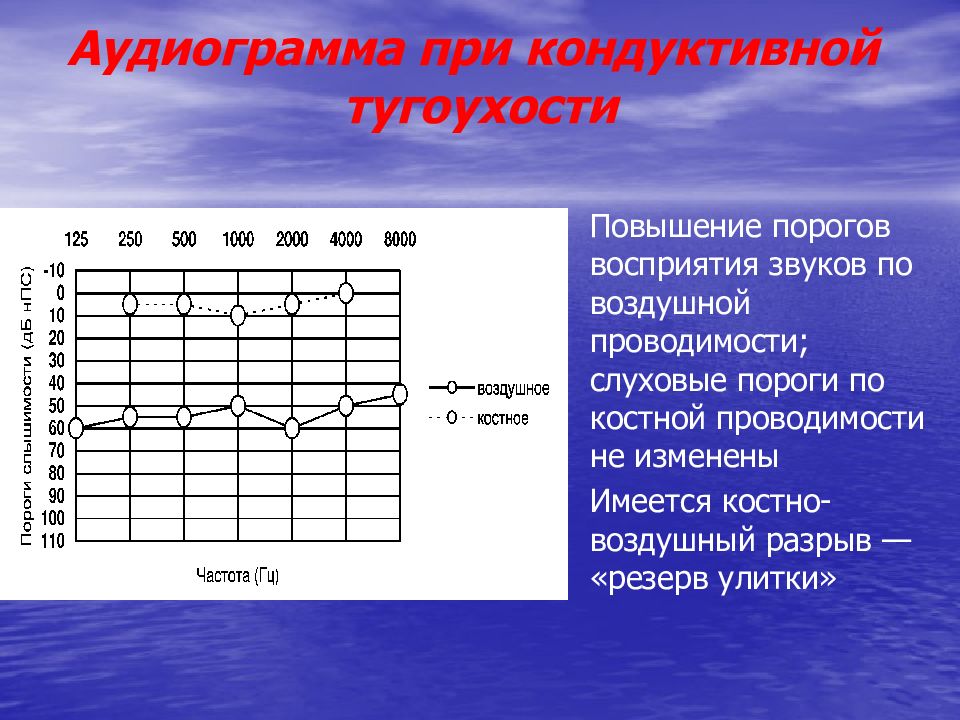 Графическое изображение на специальном бланке данных исследования состояния слуха проводимого с