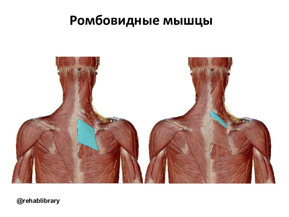 Большая и малая ромбовидная мышца