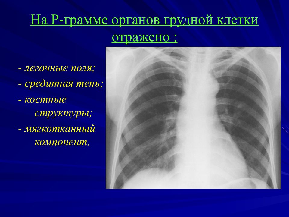 Грамма легких. Рентгенодиагностика заболеваний органов грудной клетки. Рентгенодиагностика заболеваний легких. Лучевая диагностика органов грудной клетки. Органы грудной клетки с патологией.