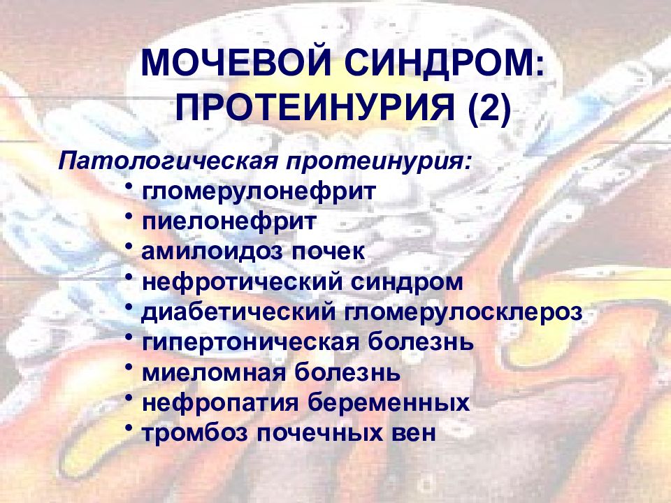 Мочевой синдром презентация терапия