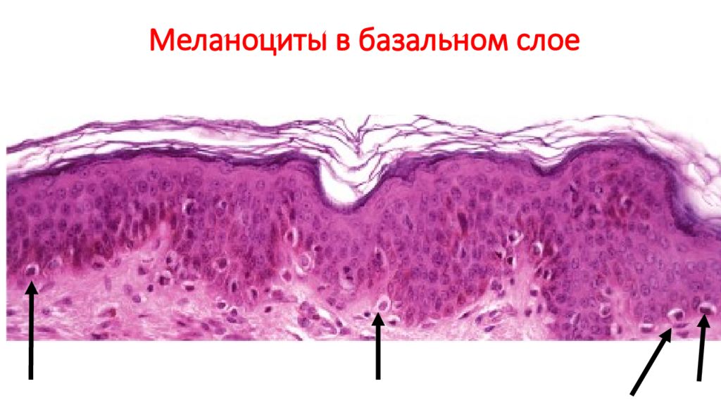 Препарат меланина. Меланоцит строение гистология. Меланоциты гистология препарат. Меланин в эпидермисе.