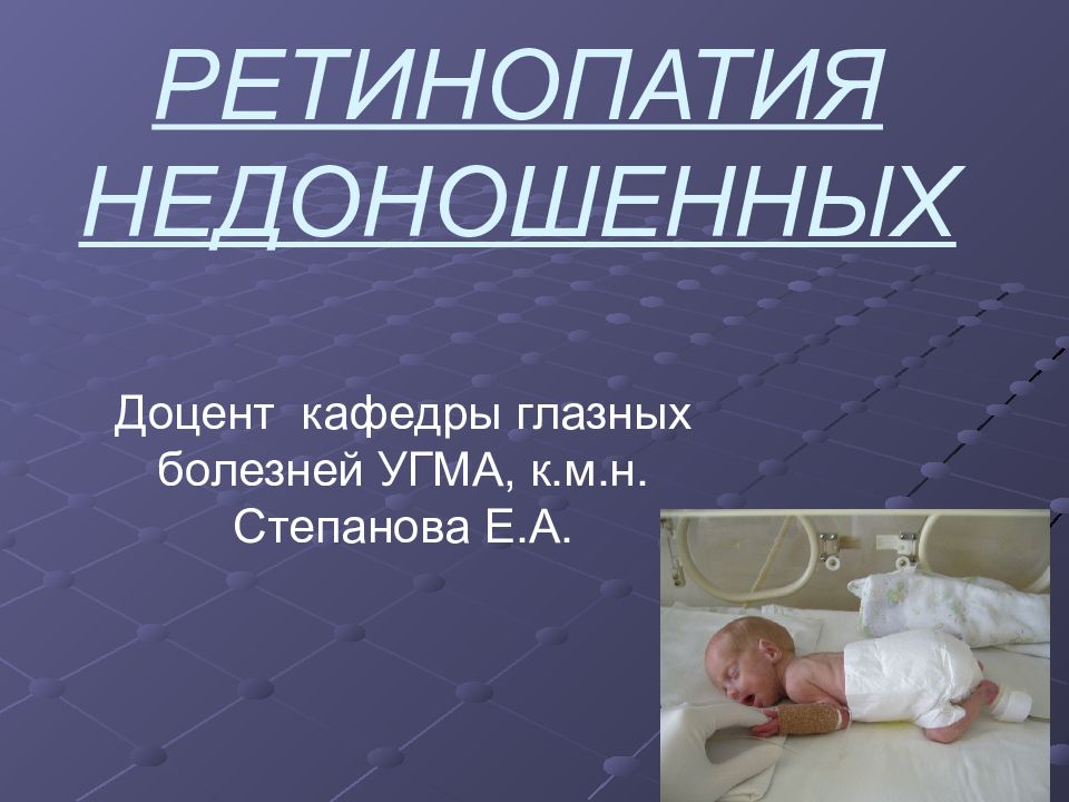 Ретинопатия недоношенных презентация