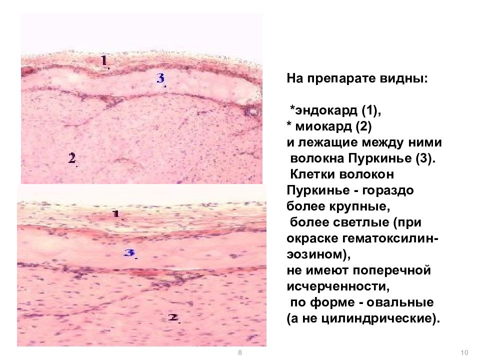 Миокард рисунок по гистологии