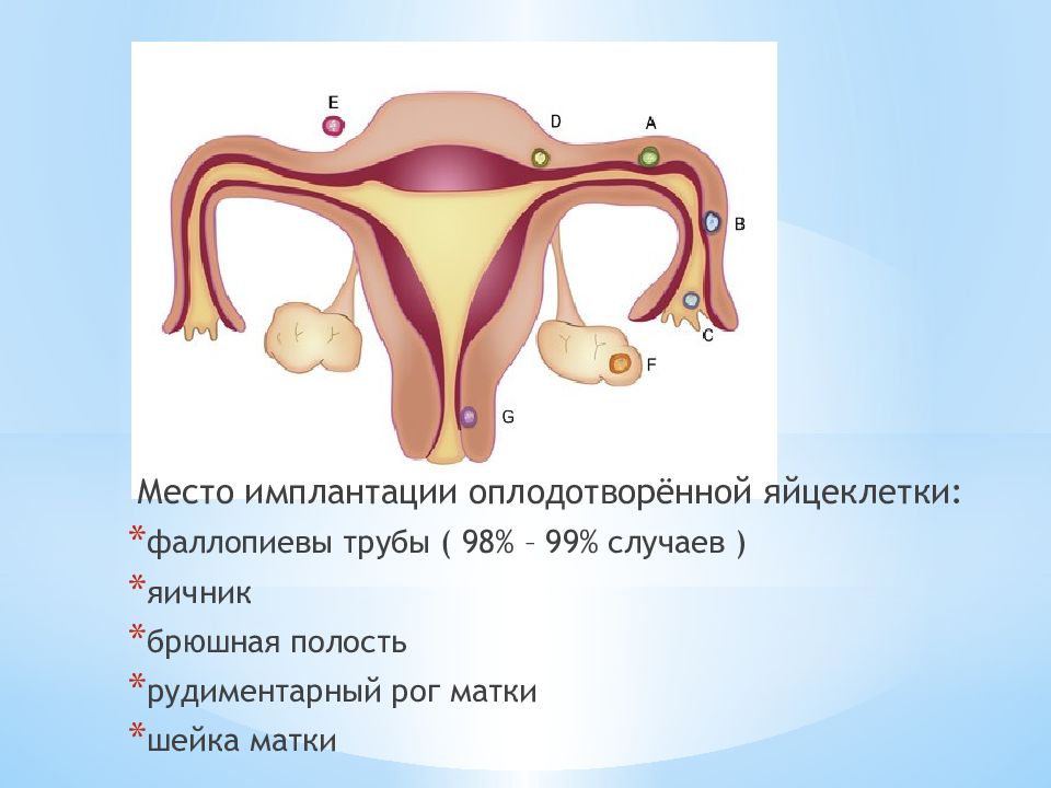 Рог матки. Внематочная беременность схема. Рудиментарный Рог матки. Яйцеклетка в матке. Имплантация оплодотворенной яйцеклетки.