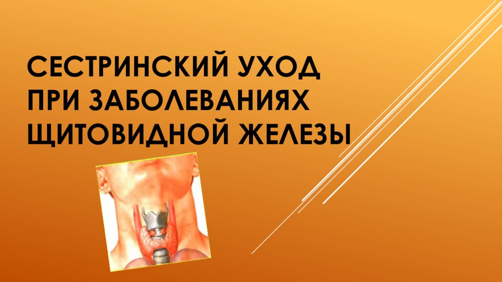 Сестринский уход при заболеваниях щитовидной железы