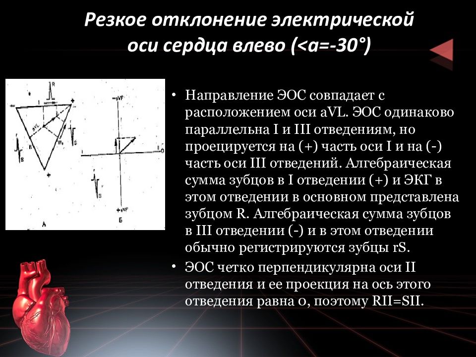 Отклонение эос на экг