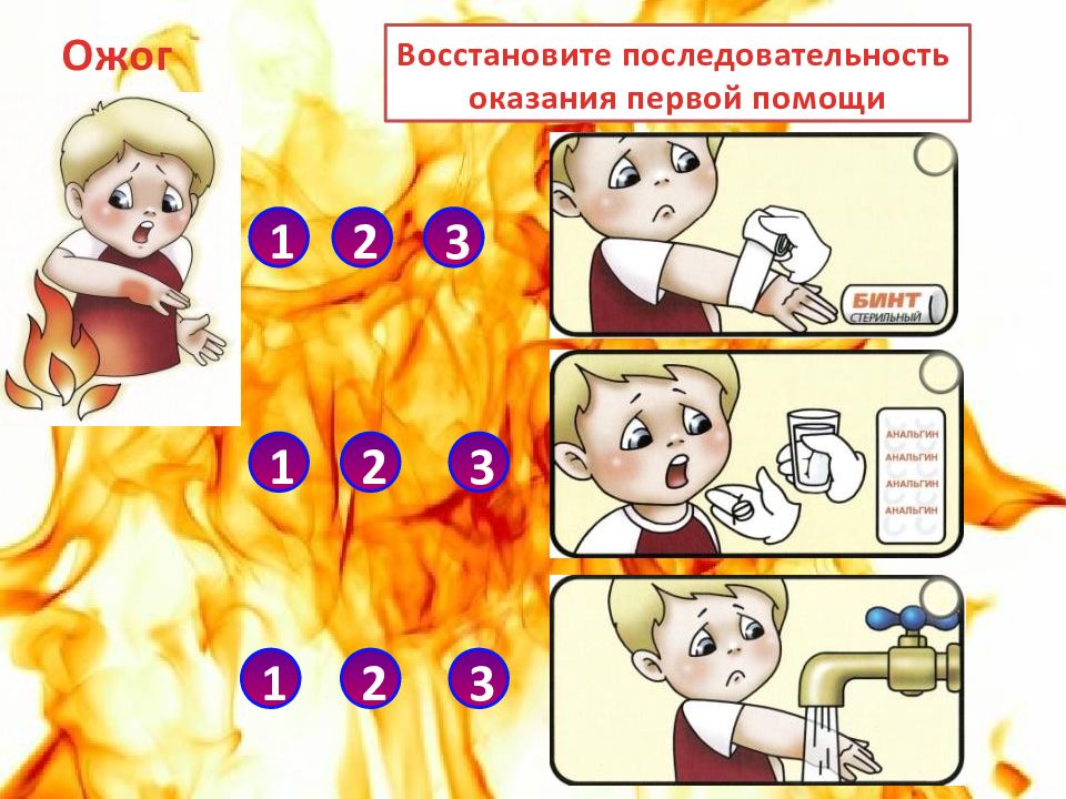 Ожоги презентация по первой медицинской помощи