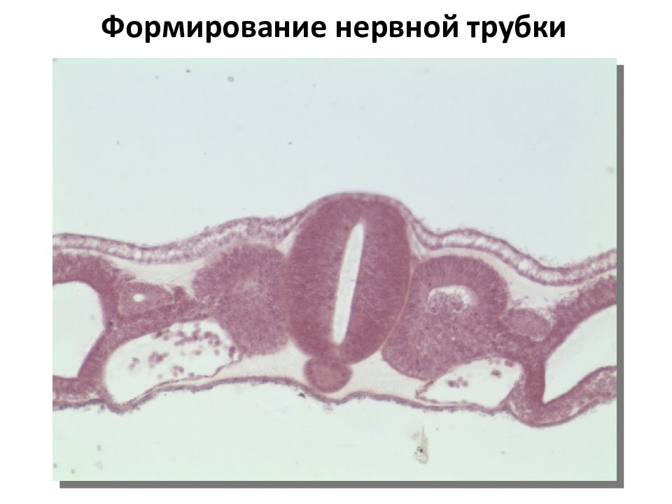 Нервная трубка. Нервная трубка гистология препарат. Строение нервной трубки гистология. Формирование нервной трубки. Формирование нервной трубки эмбриона.