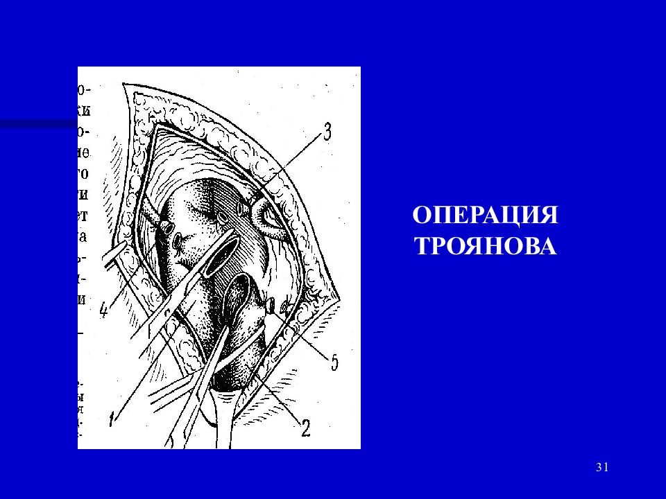 Операция троянова