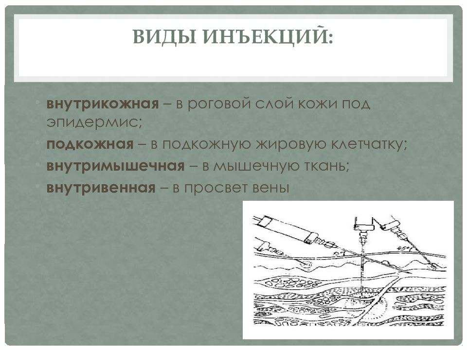 Места постановки внутрикожной инъекции. Подкожная и внутрикожная инъекция. Внутримышечные внутрикожные подкожные инъекции. Преимущества внутрикожной инъекции.