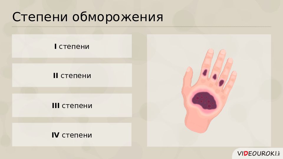 Нарушение кожных покровов и повреждение кожи презентация. Болезни и травмы кожи 8 класс. Заболевания кожи 8 класс презентация. Болезни и травмы кожи 8 класс презентация.