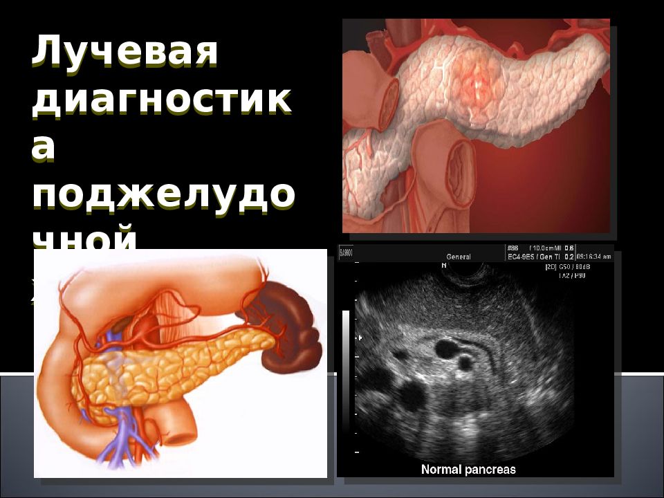 Лучевая диагностика желчевыводящих путей презентация