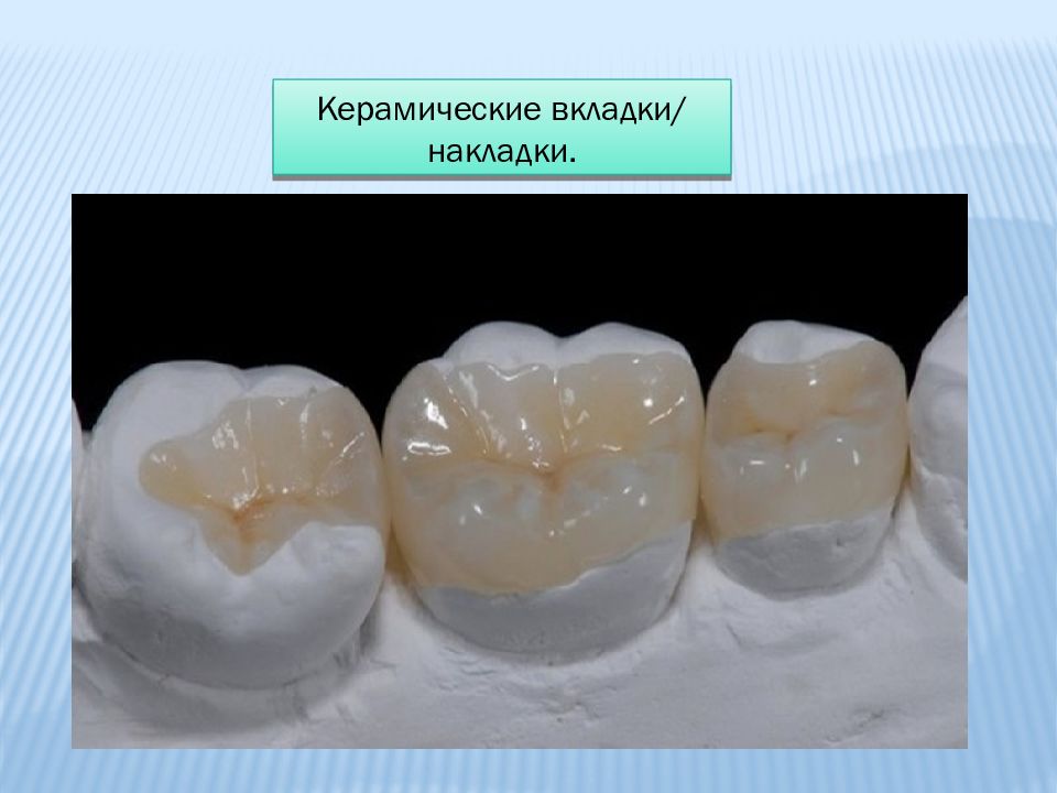 Стоматологическая керамика презентация