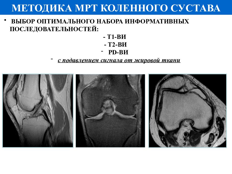 Мрт 2. Т1 и т2 мрт коленного сустава.