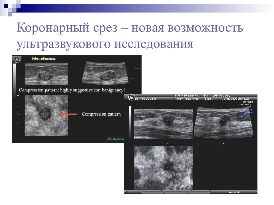 Ультразвуковое исследование презентация