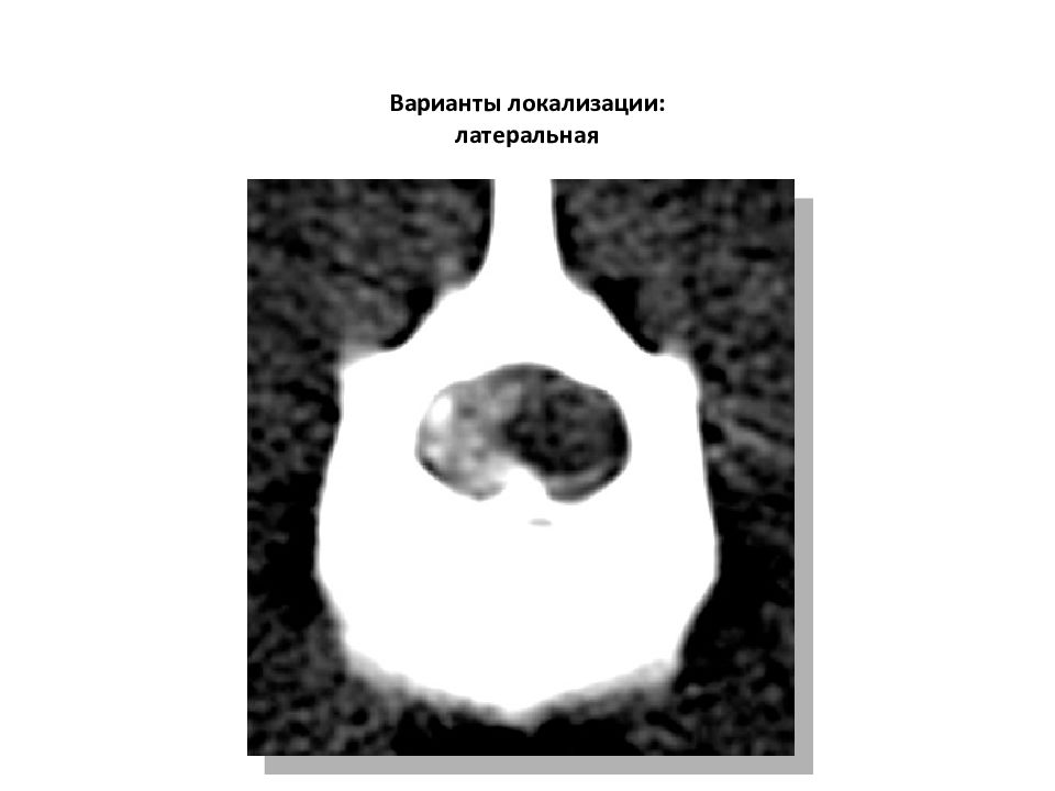 Компьютерная томография в неврологии презентация