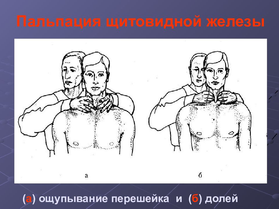 Пальпация молочной железы. Осмотр щитовидной железы алгоритм. Осмотр щитовидной железы пропедевтика. Пальпация щитовидной железы алгоритм. Пальпация щитовидной железы пропедевтика.