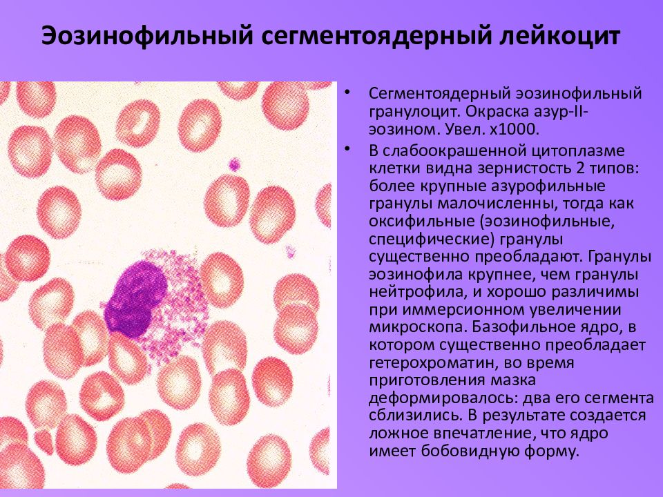 Сегментоядерные нейтрофилы. Функции сегментоядерных нейтрофилов. Азурофильные гранулы эозинофилов. Сегментоядерный эозинофильный гранулоцит. Нейтрофилы сегментоядерные 46.2.