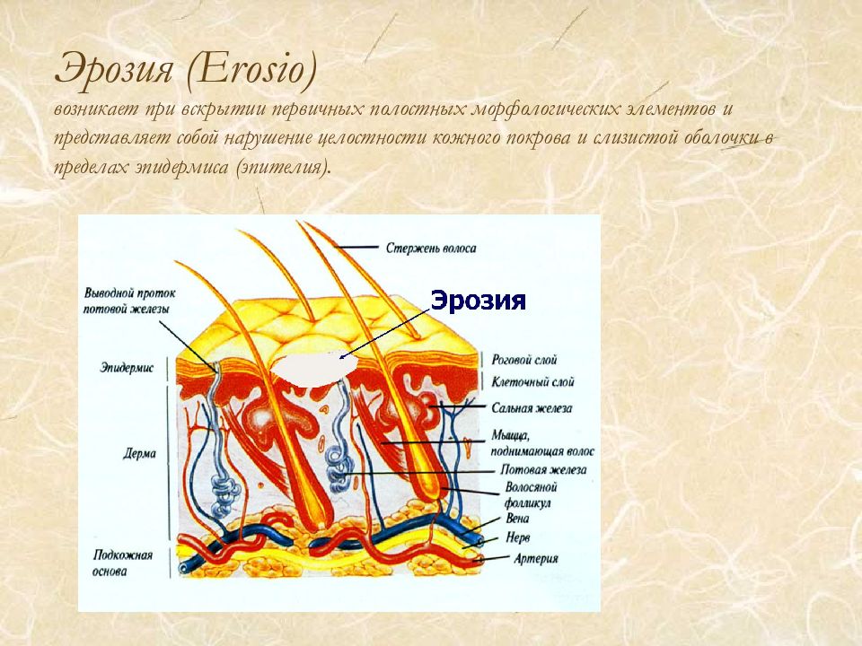 Элементы кожи. Первичные полостные элементы. Кожные покровы и слизистые оболочки. Эктима морфологический элемент. Строение морфологических элементов кожи.