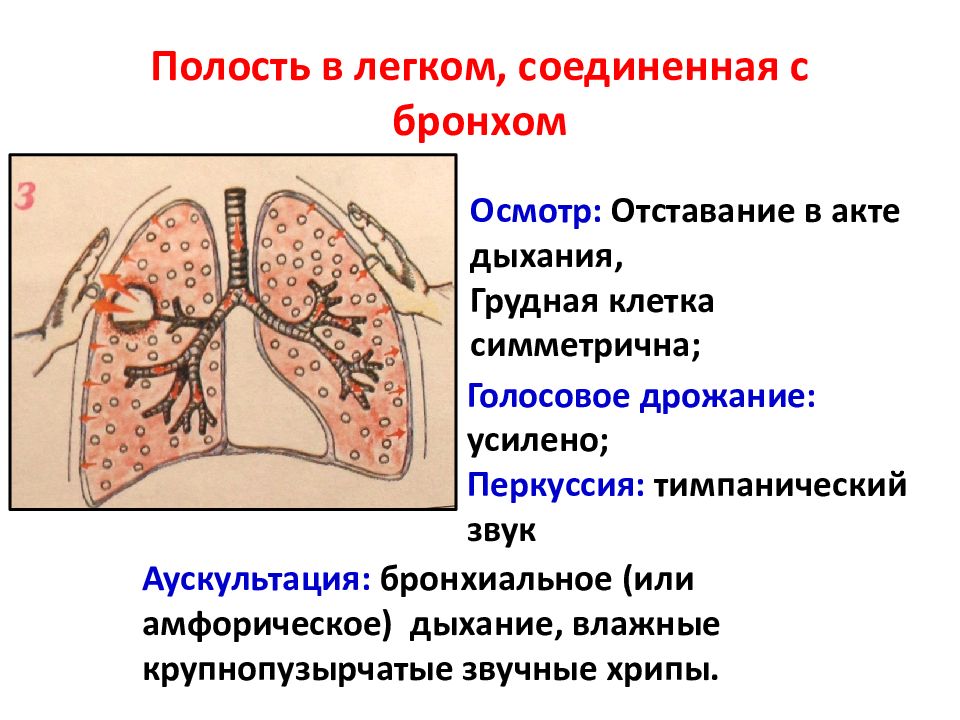 Амфорическое дыхание