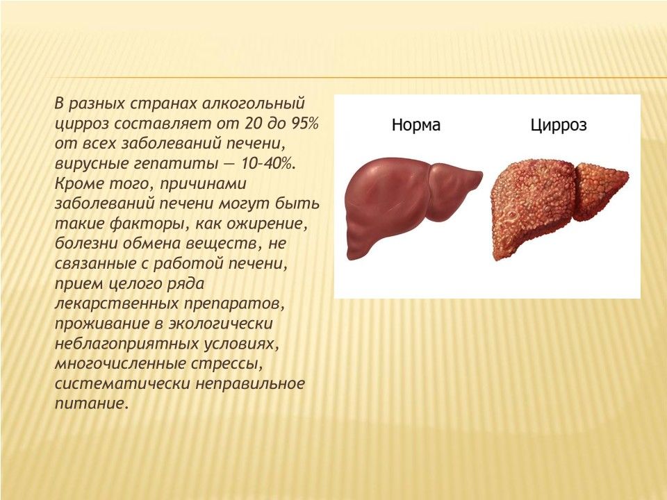 Картинки печени цирроза печени