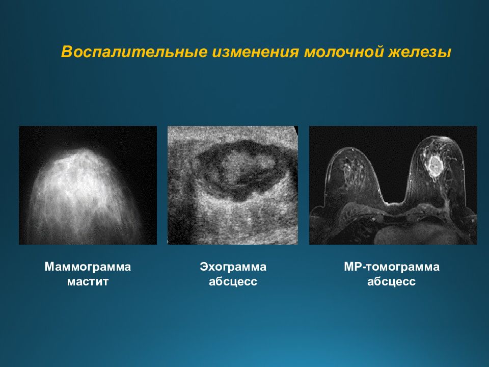 Лучевая диагностика нервной системы презентация