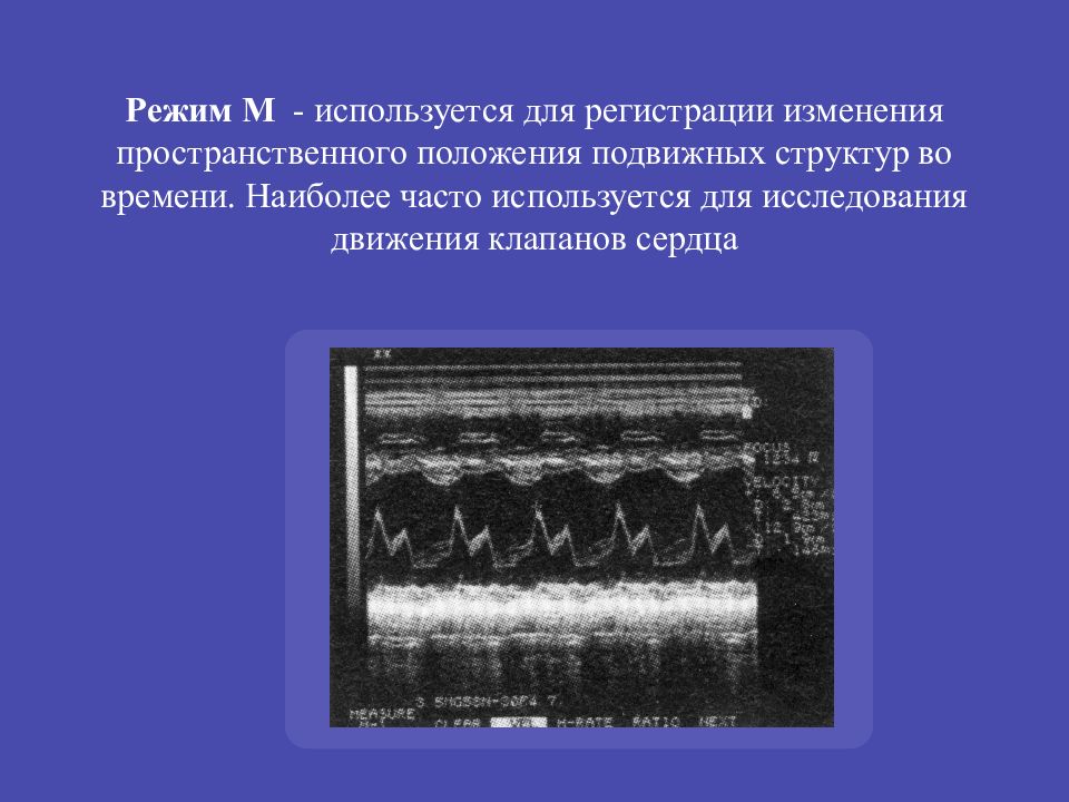 Режимы узи. М-режим ультразвукового исследования. Ультразвуковое исследование презентация лучевая диагностика. М режим УЗИ. Режимы УЗИ исследования.