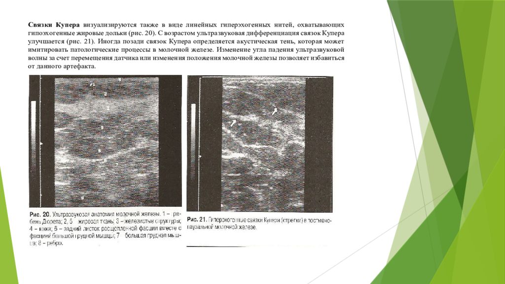 Узи молочных желез какой день цикла лучше