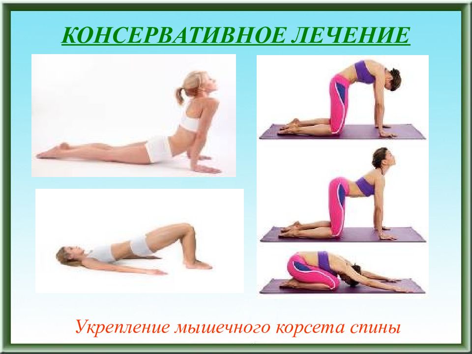 Упражнения Для Спины Дома Картинки