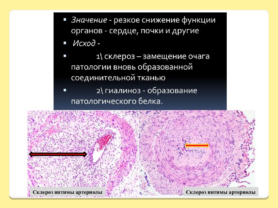 Мезенхимальные опухоли презентация