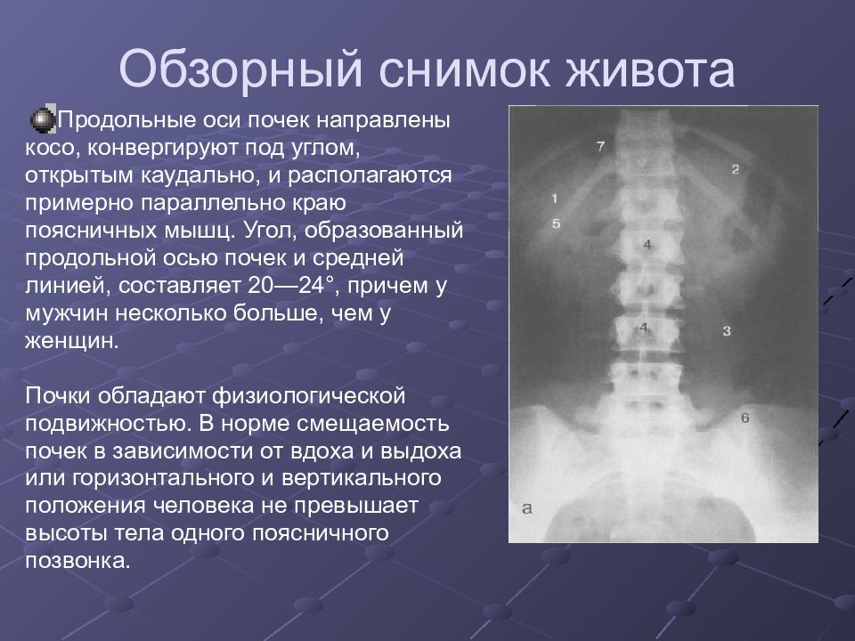 Лучевая диагностика почек презентация