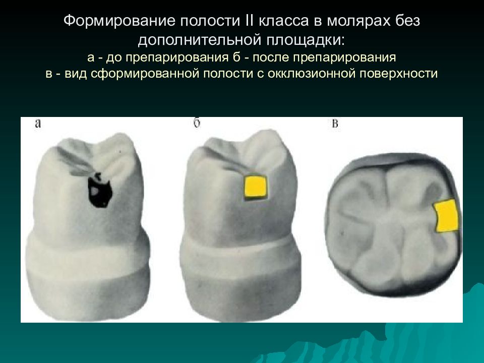 4 класс по блэку презентация