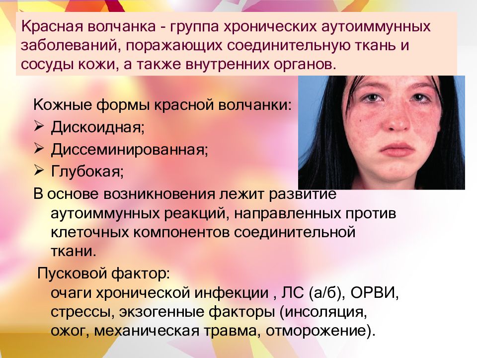 Аутоиммунные заболевания картинки