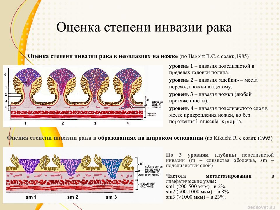 Инвазия что это. Инвазивная стадия опухоли. Инвазия в онкологии что это. Инвазия и метастазирование.