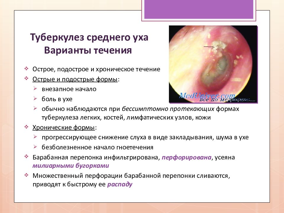 Туберкулез лор органов презентация