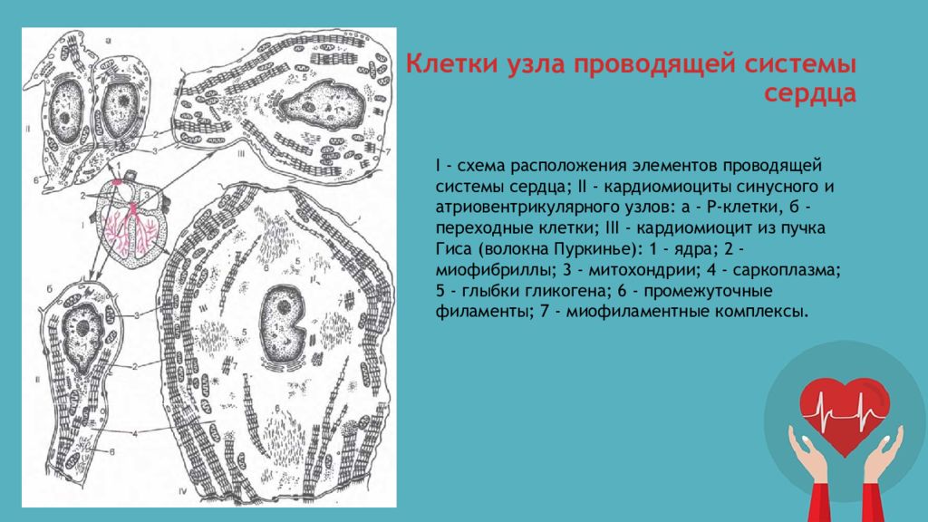 Узелки клеток. Проводящая система сердца гистология схема. Переходные клетки проводящей системы сердца гистология. Атипичные кардиомиоциты схема. Переходные клетки кардиомиоцитов.