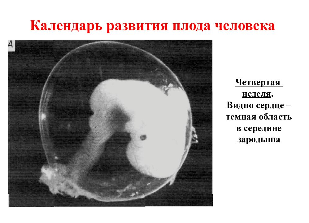 Плод 4 недели. Презентация эмбрион человека. Эмбрион человека 5 недель. 3 Эмбриональная неделя. Доклад на тему развитие плода.