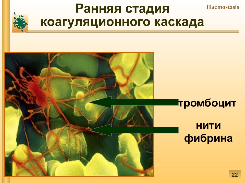 Патофизиология гемостаза презентация