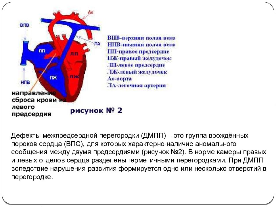 Нижняя полая вена презентация