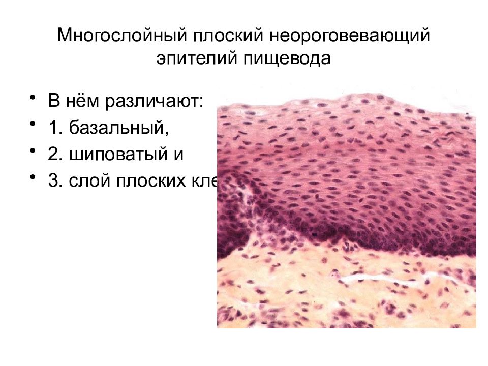 Слой плоских клеток. Многослойный плоский неороговевающий эпителий пищевода. Многослойный плоский неороговевающий эпителий строение. Многослойный плоский эпителий пищевода гистология. Многослойный плоский неороговевающий эпителий пищевода гистология.